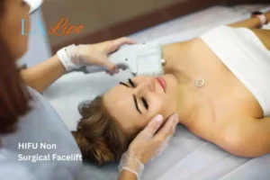 Woman having Hi-Fu to reduce wrinkles West Ham.