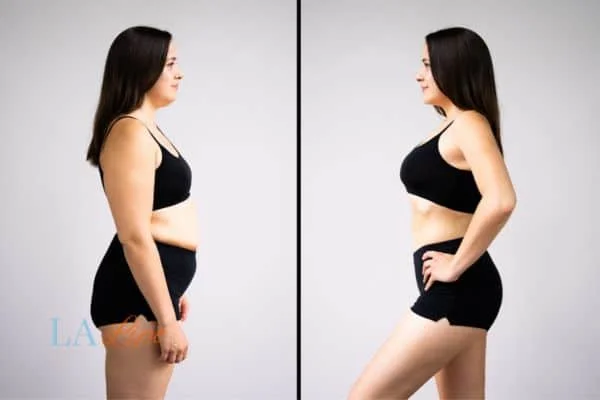 link between body image and mental health West Ham