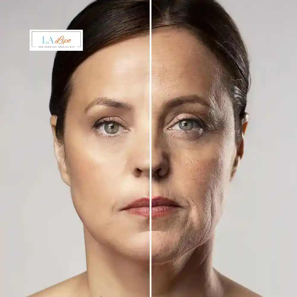 How Can You Tell If Non-Surgical Skin Tightening Is Right for You West Ham?