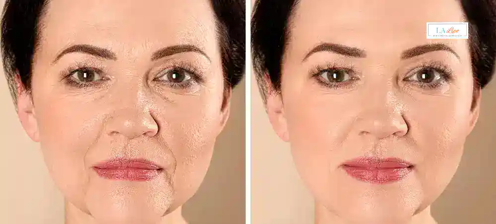 Why Aren’t My Skincare Products Making My Sagging Skin Look Firmer West Ham?