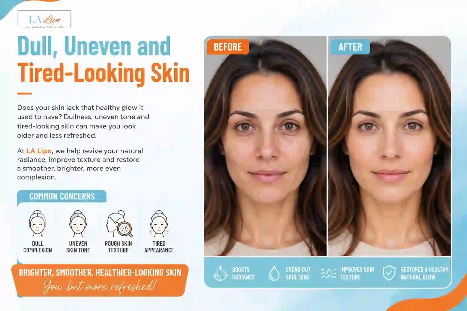 Sign #5: Dull, Uneven and Tired-Looking Skin West Ham