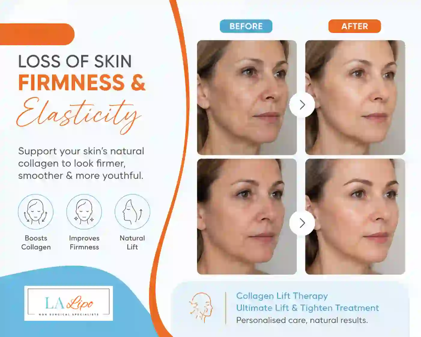 Sign #7: Loss of Skin Firmness and Elasticity West Ham